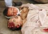 dead children from stray bulletd in Iraq War.jpg