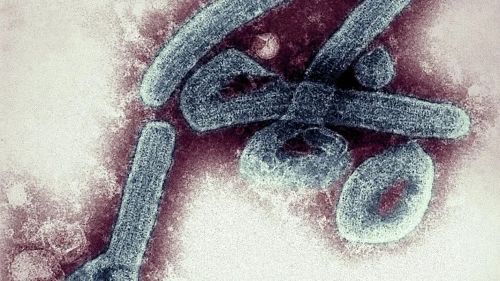 Close up of Marburg virus